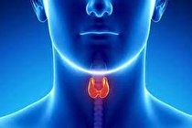 چه کسانی در معرض ابتلا به کم‌کاری تیروئید هستند؟