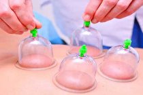 چه کسانی نباید حجامت کنند؟