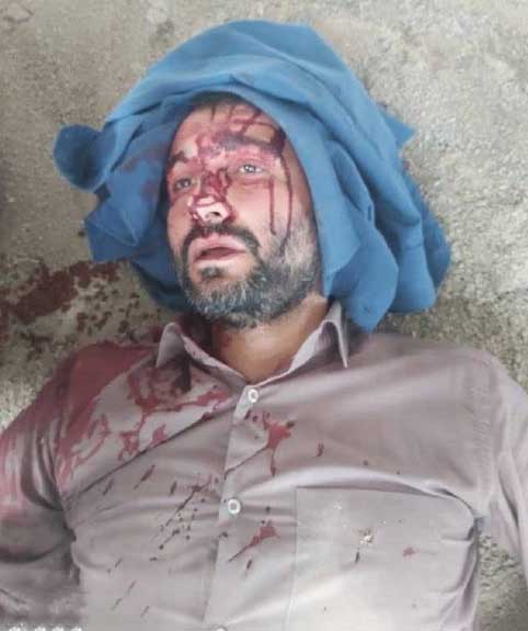 حمله به شهردار بخاطر مقابله با ساختوسازهای غیرمجاز حمله به شهردار بخاطر مقابله با ساختوسازهای غیرمجاز