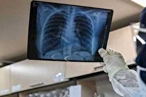 کرونا در ۴۰ کشور صعودی شد