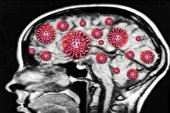 نوع شدید کرونا مغز بازماندگان را تا ۲۰ سال پیر می کند