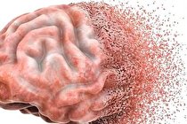 ساده‌ترین راه برای در امان ماندن از زوال عقل