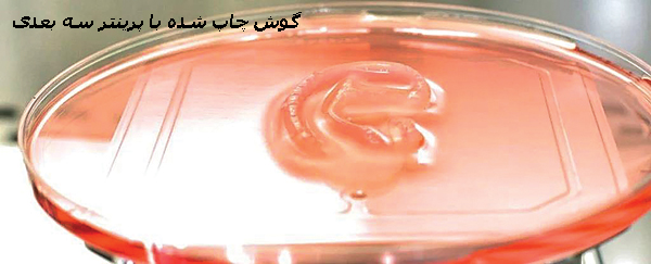 اولین پیوند گوش چاپی اولین پیوند گوش چاپی