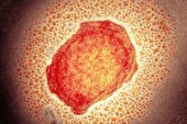 آبله میمونی چقدر مسری است؟