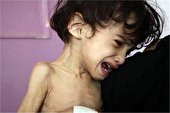 بهره‌مندی 1000 کودک یزدی مبتلا به سوء تغذیه از برنامه امنیت غذایی کمیته امداد