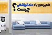انتخاب بهترین کمپرسور دندانپزشکی