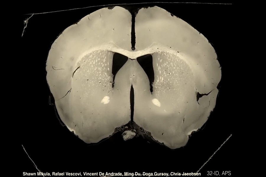 رمزگشایی از ذهن با مطالعه سیم‌کشی‌های مغز در سطح نانو