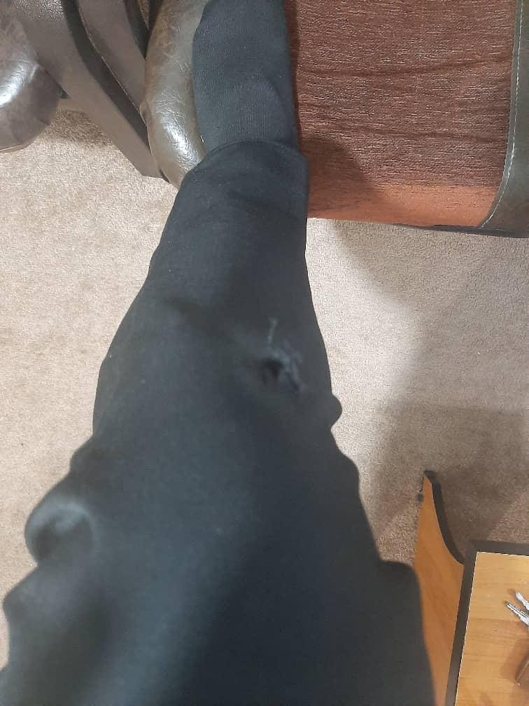 ببینید| حمله سگ ها به اورژانس