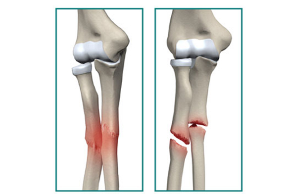 ۲۶ فوتی و شناسایی ۶۹۲۱ بیمار جدید کرونا در کشور ۲۶ فوتی و شناسایی ۶۹۲۱ بیمار جدید کرونا در کشور