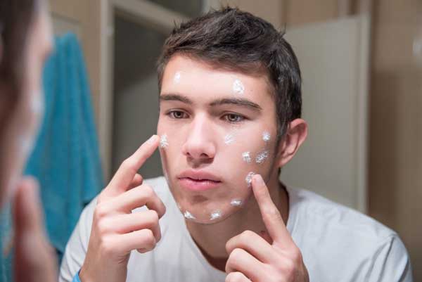 موثرترین روش ها برای جلوگیری از جوش صورت