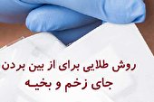 ترمیم و از بین بردن جای زخم و بخیه با محصولات اسکارهیل