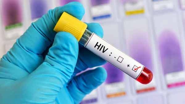 کرونا مبارزه با HIV را به حاشیه برد ‌|  ترس از برچسب زنی ادامه دارد