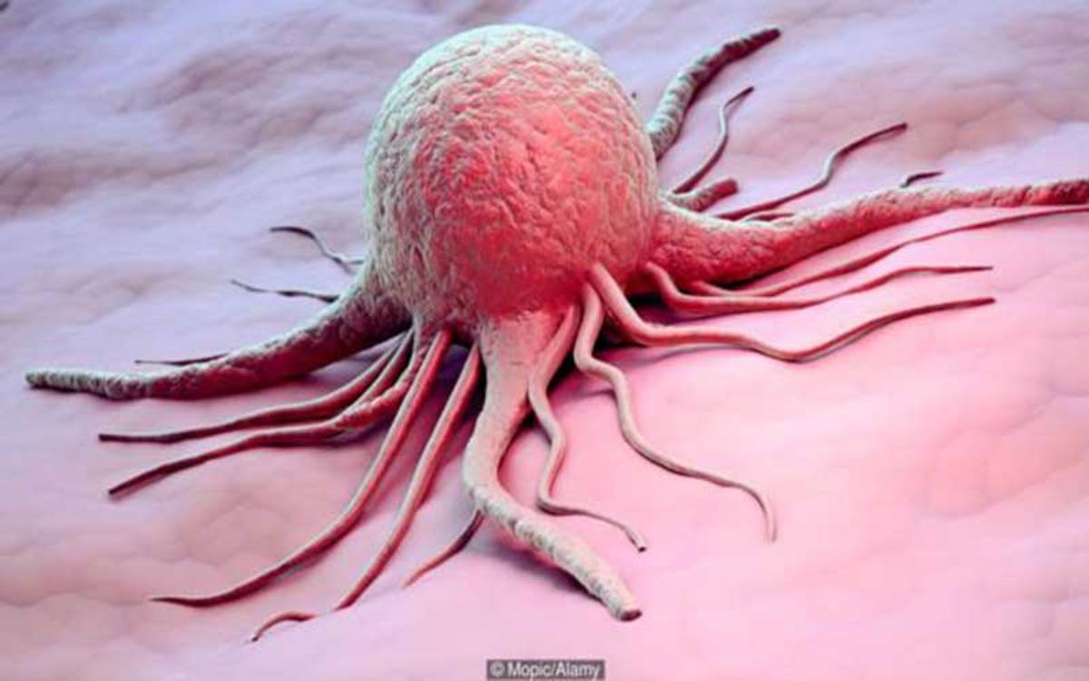 تومور مغزی گلیوبلاستوما از خطرناک‌ترین تومورهای سرطانی است که در سال‌های اخیر تمرکز بسیاری از گروه‌های تحقیقاتی را به خود جلب کرده است.