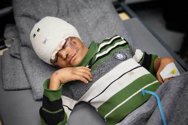 عکس | معلولیتهای کودکان فلسطینی در نتیجه حملات اشغالگران به غزه عکس | معلولیتهای کودکان فلسطینی در نتیجه حملات اشغالگران به غزه