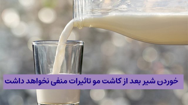 خوردن شیر بعد از کاشت مو مجاز است؟ خوردن شیر بعد از کاشت مو مجاز است؟