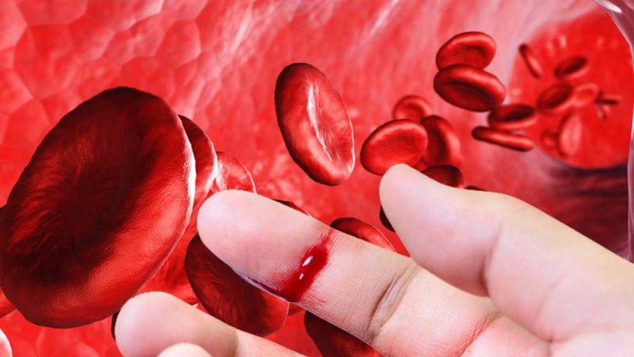 بازگشت به شیوههای درمانی 40 سال پیش | بیماران هموفیلی دارو ندارند   بازگشت به شیوههای درمانی 40 سال پیش | بیماران هموفیلی دارو ندارند