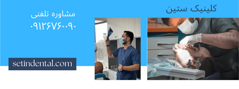 چطور می توانیم لبخندی زیبا داشته باشیم؟ چطور می توانیم لبخندی زیبا داشته باشیم؟