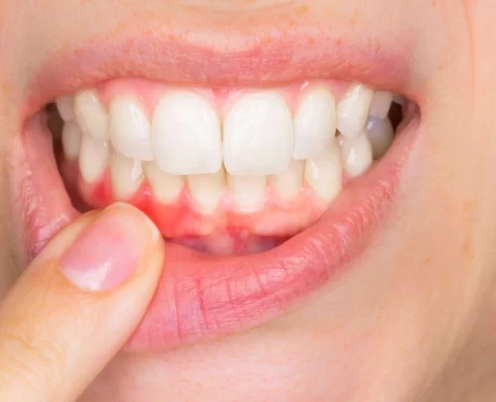 دندانپزشکی شبانه روزی غرب تهران دندانپزشکی شبانه روزی غرب تهران