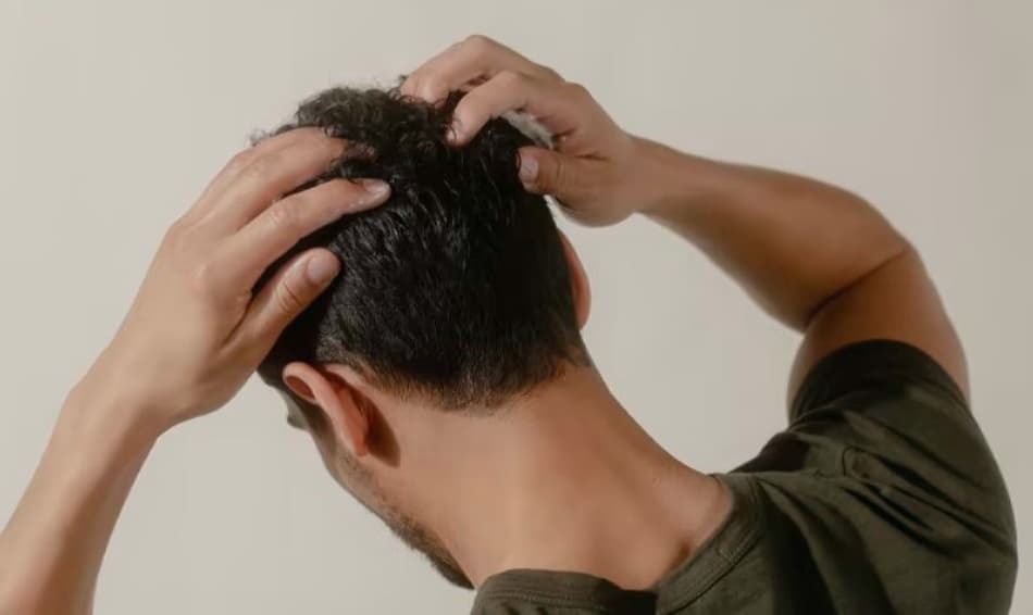 چه عواملی باعث ریزش موی سر میشوند؟ چه عواملی باعث ریزش موی سر میشوند؟