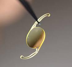 اشنایی کامل با لنز چشم، مصاحبه اختصاصی با لنز شو اشنایی کامل با لنز چشم، مصاحبه اختصاصی با لنز شو