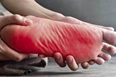 «گزگز پا» را چگونه درمان کنیم؟