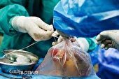 اهدای اعضای بیمار مرگ مغزی نجات بخش جان بیماران نیازمند شد.