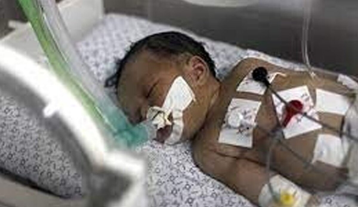 منابع خبری از تداوم شهادت بیماران در بیمارستان تحت محاصره شفا در غزه خبر می‌دهند.