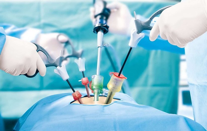 تشخیص کیست تخمدان و اقدامات لازم