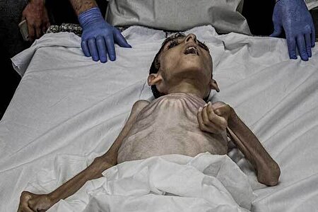 شهادت ۳۰ کودک در نتیجه گرسنگی در غزه شهادت ۳۰ کودک در نتیجه گرسنگی در غزه