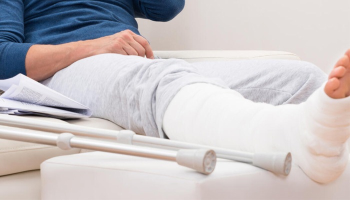 چگونه بعد از شکستگی مچ پا شروع به راه رفتن کنیم؟ چگونه بعد از شکستگی مچ پا شروع به راه رفتن کنیم؟