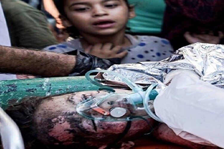 تداوم حملات سنگین علیه نوار غزه | المواصی همچنان زیر بمباران شدید