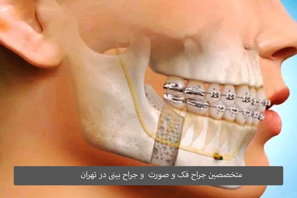 جراحی فک و صورت و بینی جزو عمل‌های سخت و هزینه‌بر به شمار می‌روند؛ بنابراین برای انجام آن‌ها باید به بهترین جراحان مراجعه کنید تا از نتیجه جراحی رضایت کافی داشته باشید.