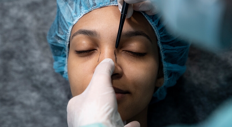 عمل بینی چند ساعت طول می‌کشد؟