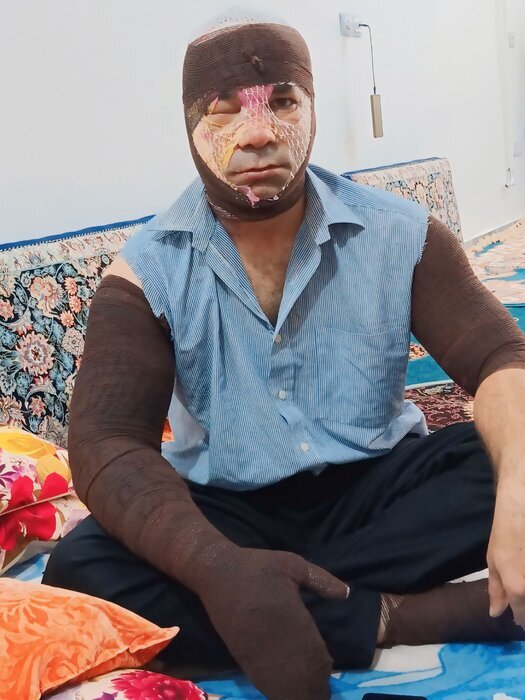 ببینید | لحظات نفس‌گیر نجات راننده نیسان از میان شعله‌های آتش