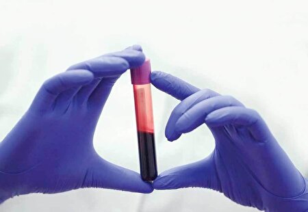 ببینید | دیابت، بیماری ناشی از چاقی و اضافه وزن