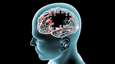 کشف متهم جدید آلزایمر