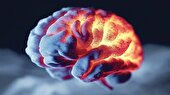 بیماری خاموش مغز