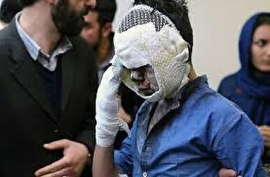 چهارشنبه‌ سوری نیامده ۳ مصدوم گرفت