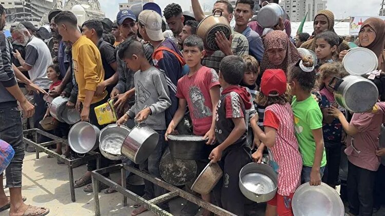 هزاران کودک غزه با سوءتغذیه مواجه هستند