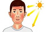 مراقبت از پوست در برابر آفتاب تابستان، ضروری‌تر از همیشه