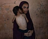 گرسنگی در غزه نسل کشی است هیچکس نباید غافلگیر شود