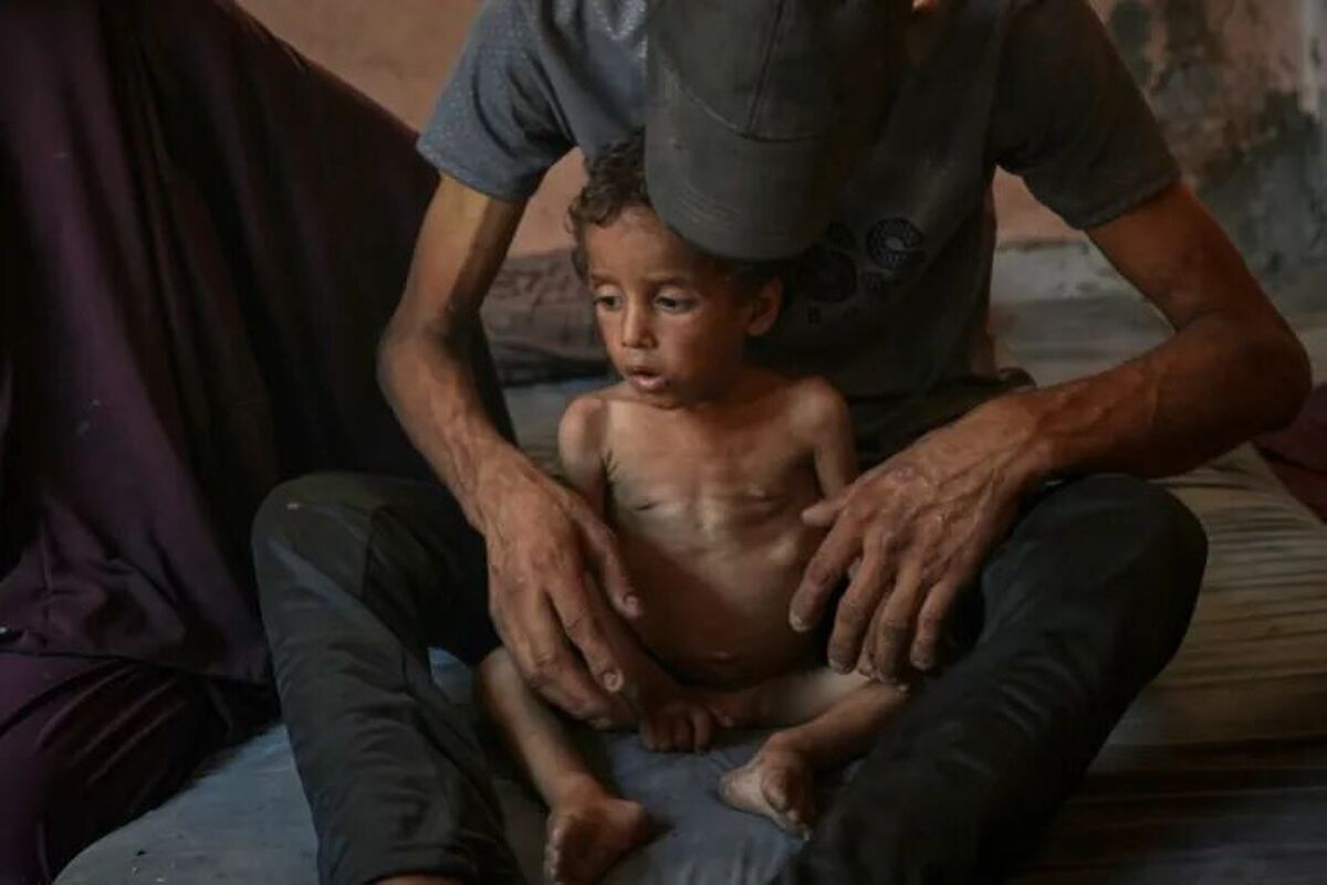 شهادت ۲۲۷ نفر در غزه به دلیل گرسنگی و سوءتغذیه