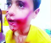امیرعلی‌، قربانی سگ‌ ولگرد