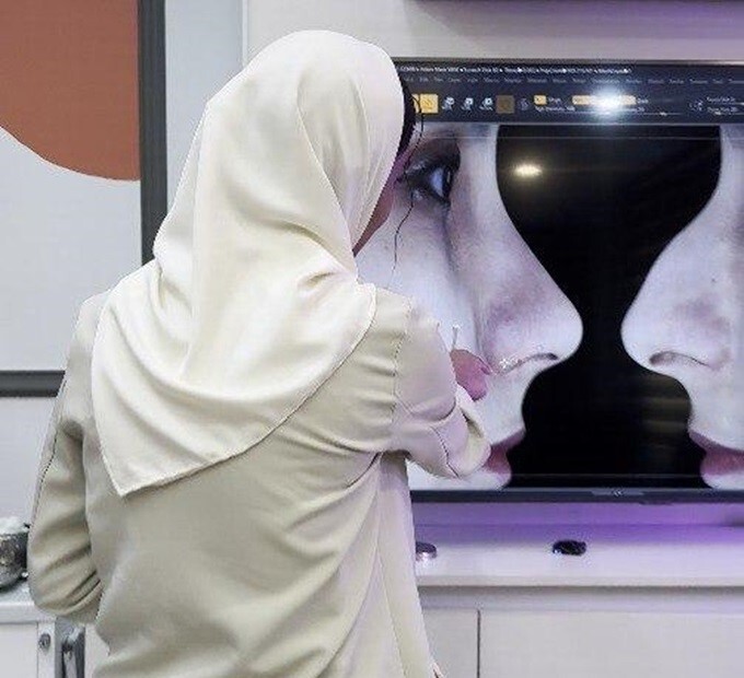 قبل از اینکه تصمیم بگیرم جراحی بینی انجام بدم، این تجربه راوانا مسیرم را تغيير داد!