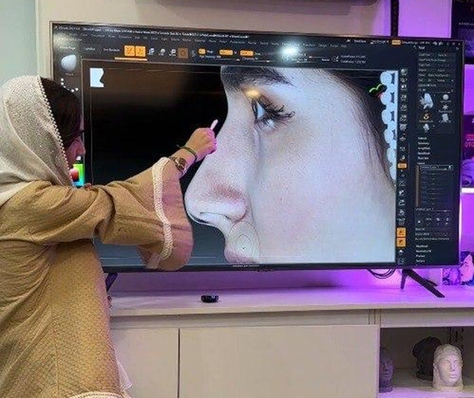 قبل از اینکه تصمیم بگیرم جراحی بینی انجام بدم، این تجربه راوانا مسیرم را تغيير داد!