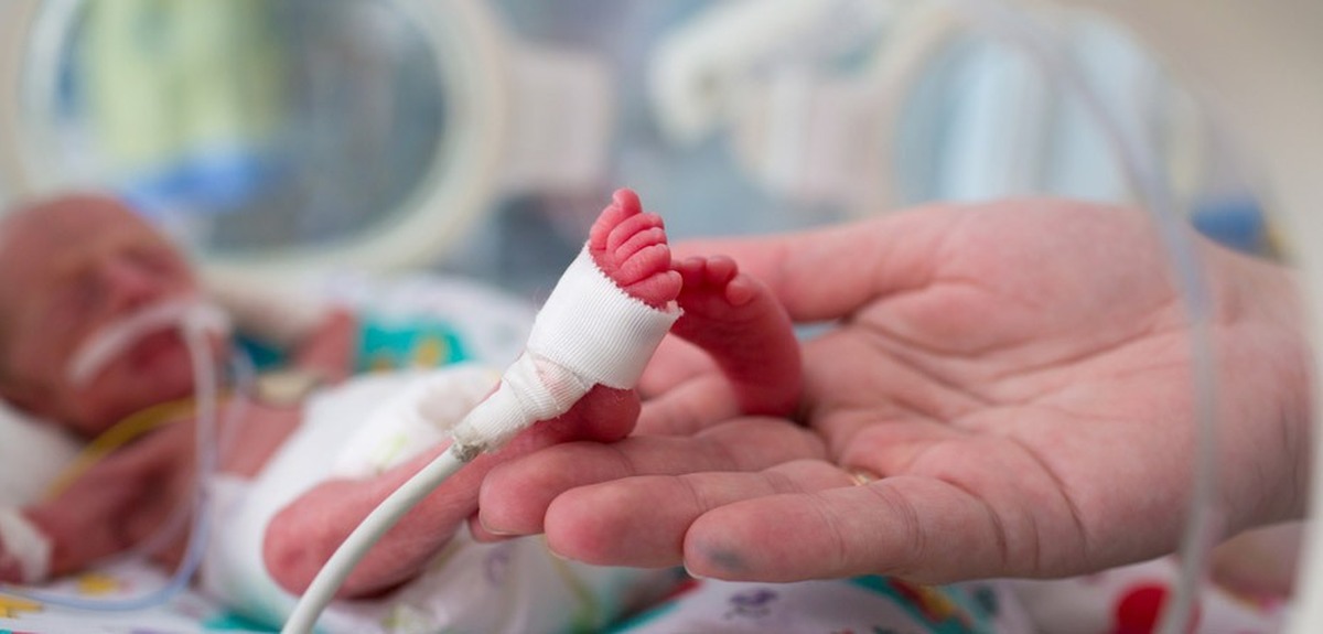 رئیس دانشگاه علوم پزشکی البرز به مناسبت روز جهانی نوزاد نارس (۱۷ نوامبر برابر با ۲۶ آبان‌ماه) با اشاره به شعار امسال با عنوان «شروع سالم، آینده‌ای امیدبخش برای نوزادان نارس» گفت: این شعار بر حق هر کودک برای برخورداری از یک آغاز عادلانه در زندگی تأکید دارد و یادآور می‌شود که نوزادان نارس علاوه بر شانس بقا، نیازمند فرصت رشد و شکوفایی هستند.