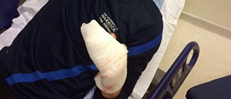 قطع انگشت هنگام سرقت موبایل