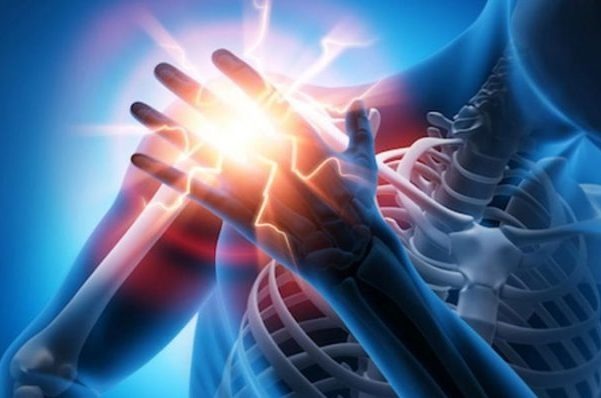 شانه منجمد چیست/تشخیص زودهنگام و شروع درمان، کلید بهبود