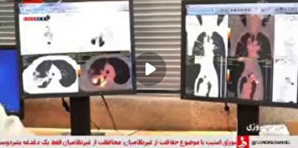 ببینید | تداوم تولید رادیودارو‌های بومی