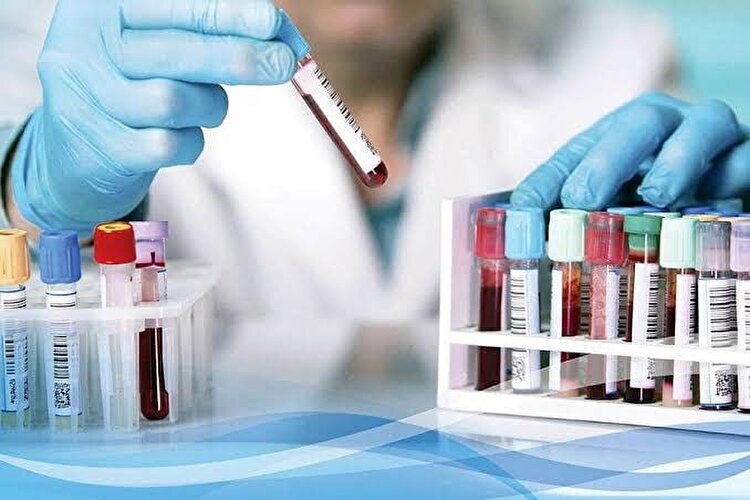 خطا‌های آزمایشگاهی در ایران به کمتر از یک درصد رسید 